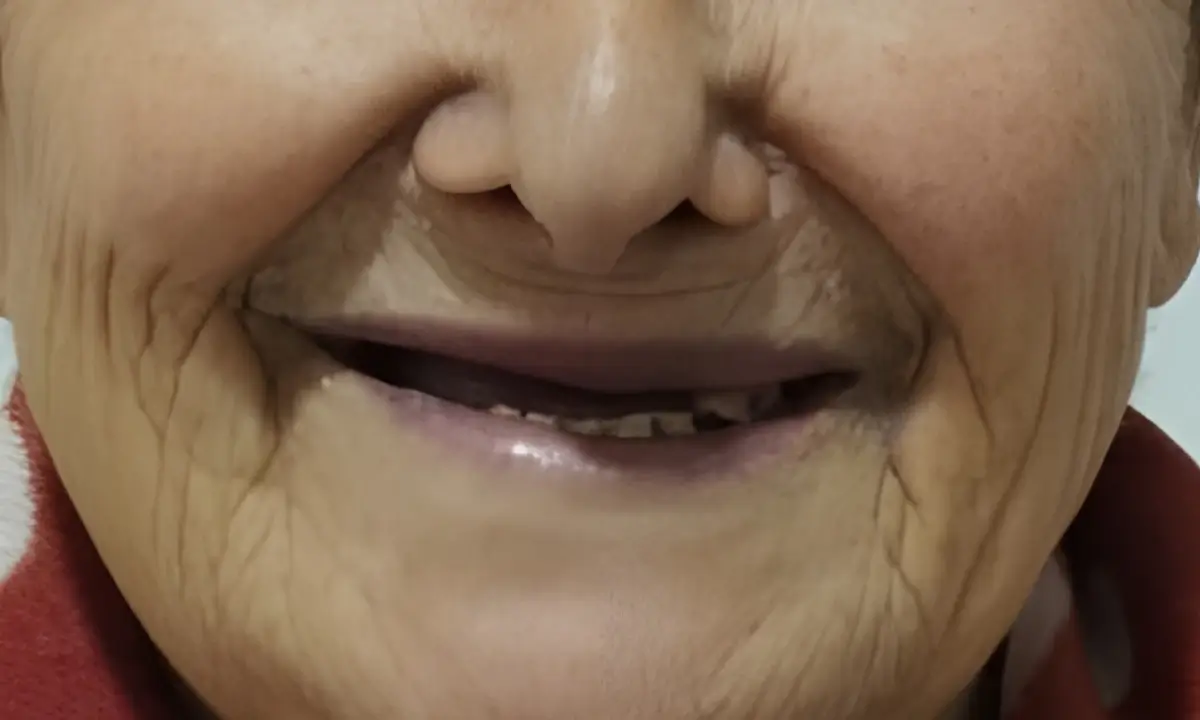 estética-dentária-antes1