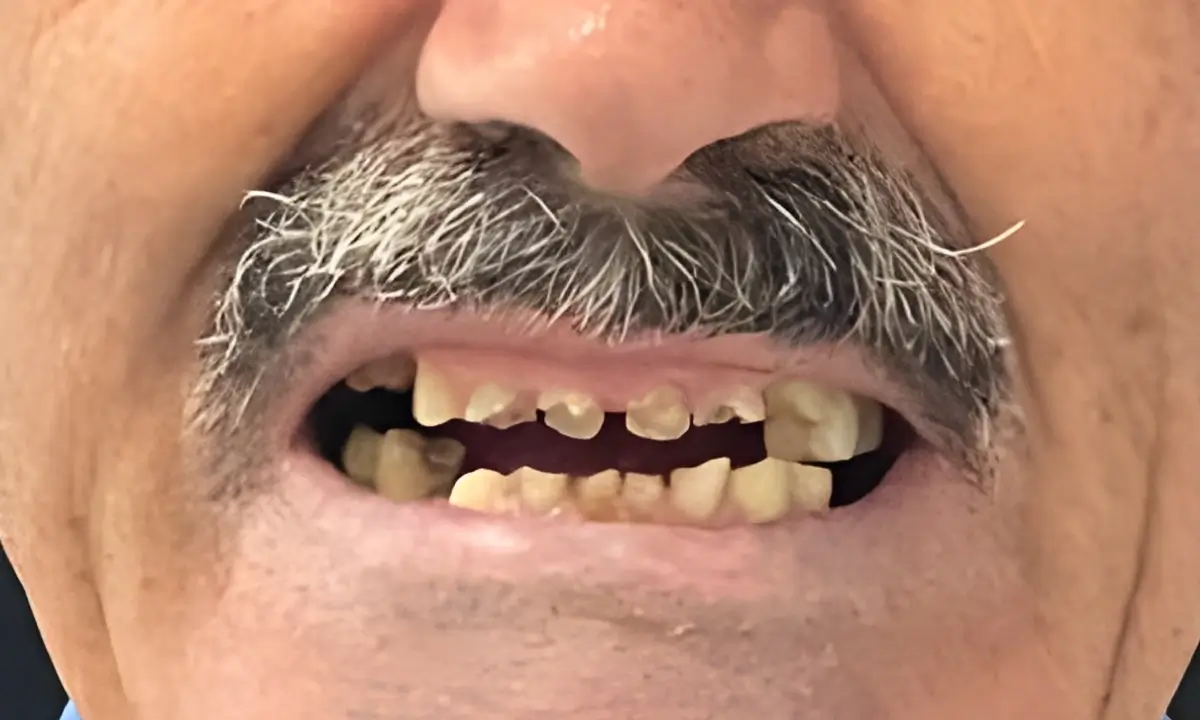 estética-dentária-antes-2